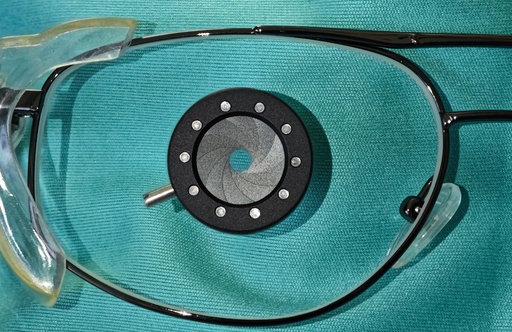 myDRYfire Irisblende